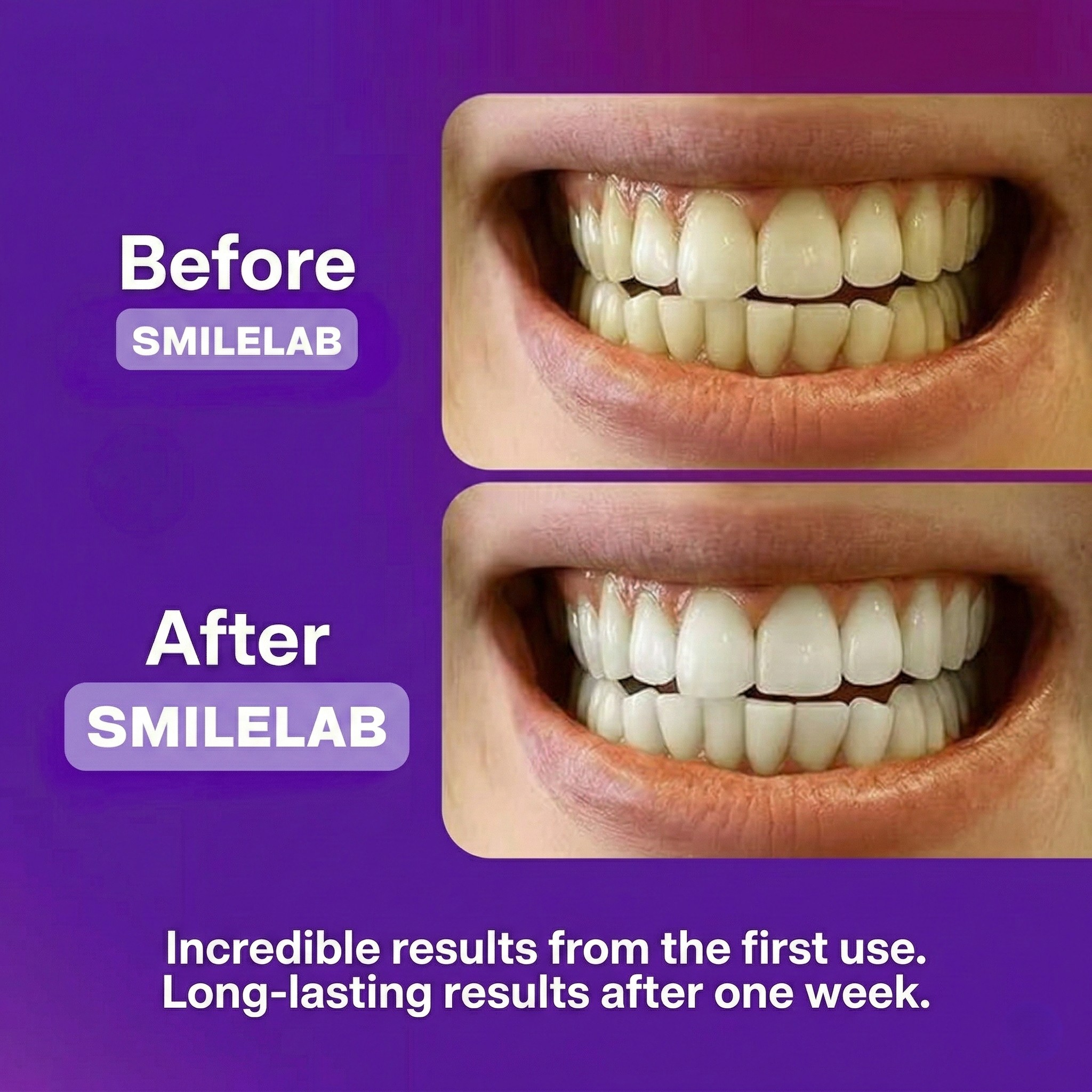 Whitening Strips – PAP+ Peroxide Free | Nuveah